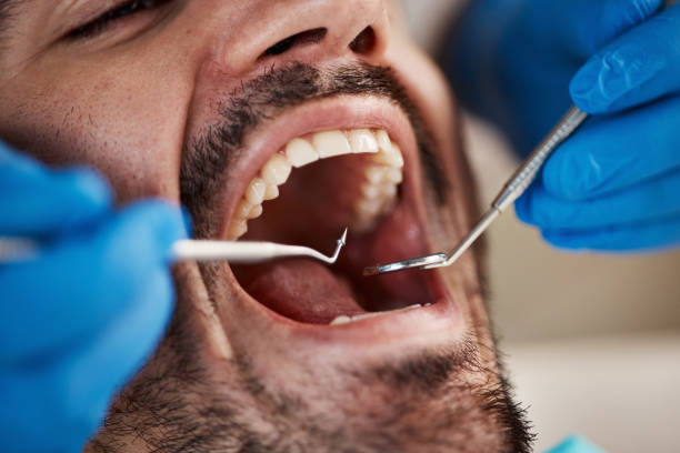 Best Pediatric Emergency Dentist in Gladstone, OR