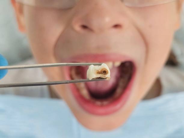 Best Weekend Emergency Dentist in Gladstone, OR